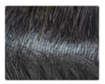 Skin Knot - immagine 3